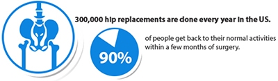 Are You Ready for Hip Replacement?